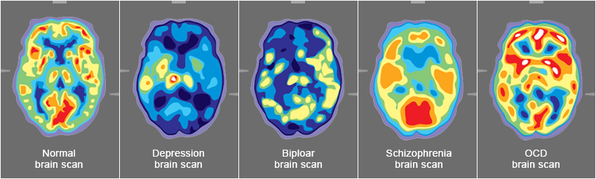 Brain Scan Images