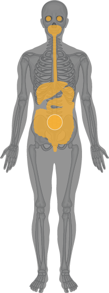 Sarin in the human eye